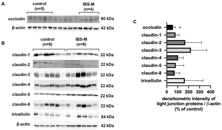 https://cdn.ncbi.nlm.nih.gov/pmc/blobs/f4f7/9856377/69a823a03f62/cells-12-00236-g004.jpg