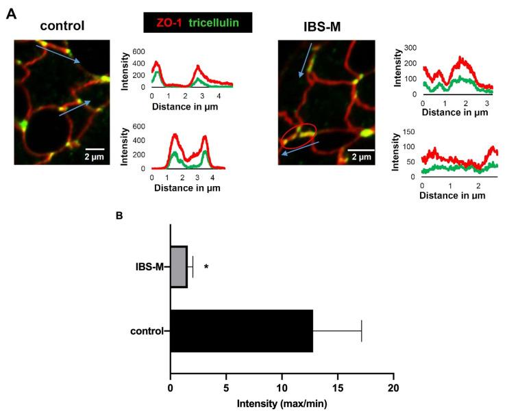 https://cdn.ncbi.nlm.nih.gov/pmc/blobs/f4f7/9856377/c80b33c63b8c/cells-12-00236-g005a.jpg