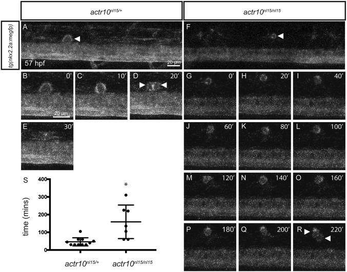 https://cdn.ncbi.nlm.nih.gov/pmc/blobs/f549/5664533/a56283e3de65/pnas.1711088114fig04.jpg