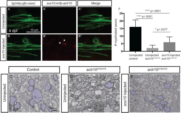 https://cdn.ncbi.nlm.nih.gov/pmc/blobs/f549/5664533/f3625fa590d0/pnas.1711088114fig05.jpg