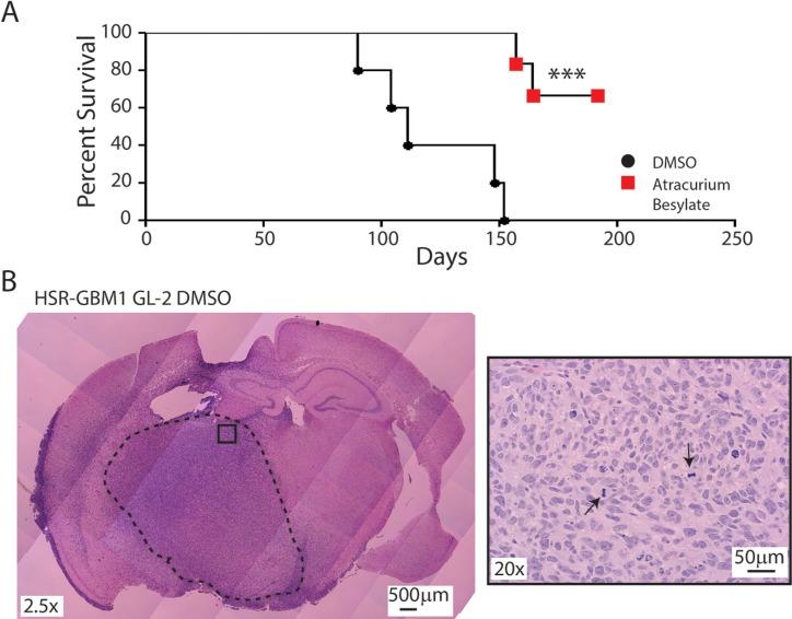 https://cdn.ncbi.nlm.nih.gov/pmc/blobs/f6e6/4808011/0dabfdd35d71/oncotarget-07-0459-g005.jpg