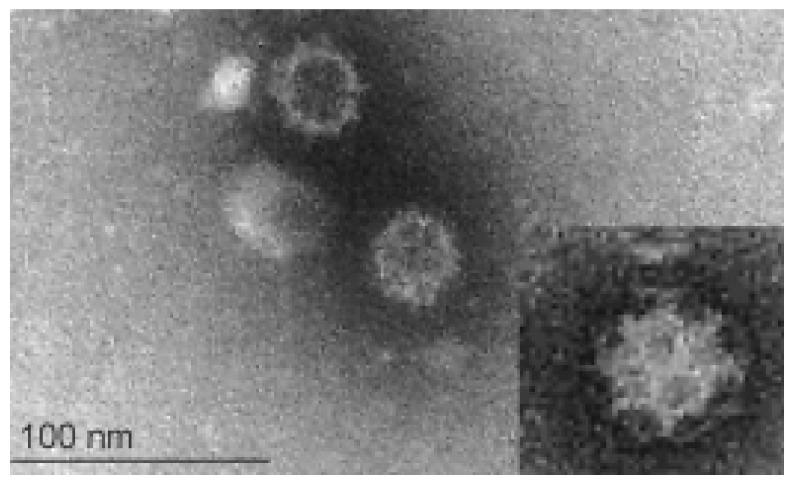 https://cdn.ncbi.nlm.nih.gov/pmc/blobs/f71f/9145992/76af50660b8d/viruses-14-00937-g001.jpg