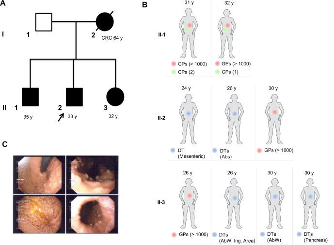 https://cdn.ncbi.nlm.nih.gov/pmc/blobs/f75f/7231465/3b673bfef417/jmedgenet-2019-106299f01.jpg