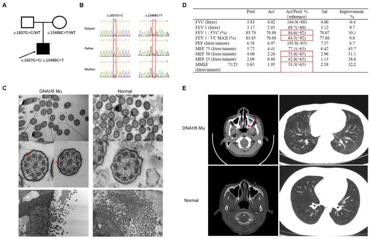 https://cdn.ncbi.nlm.nih.gov/pmc/blobs/fa1d/9776854/4711b6d99a98/cells-11-04013-g001.jpg