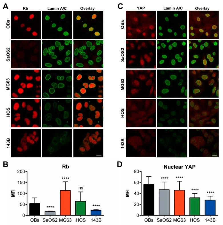 https://cdn.ncbi.nlm.nih.gov/pmc/blobs/fc80/7073215/531e4572d7a6/cancers-12-00443-g011.jpg