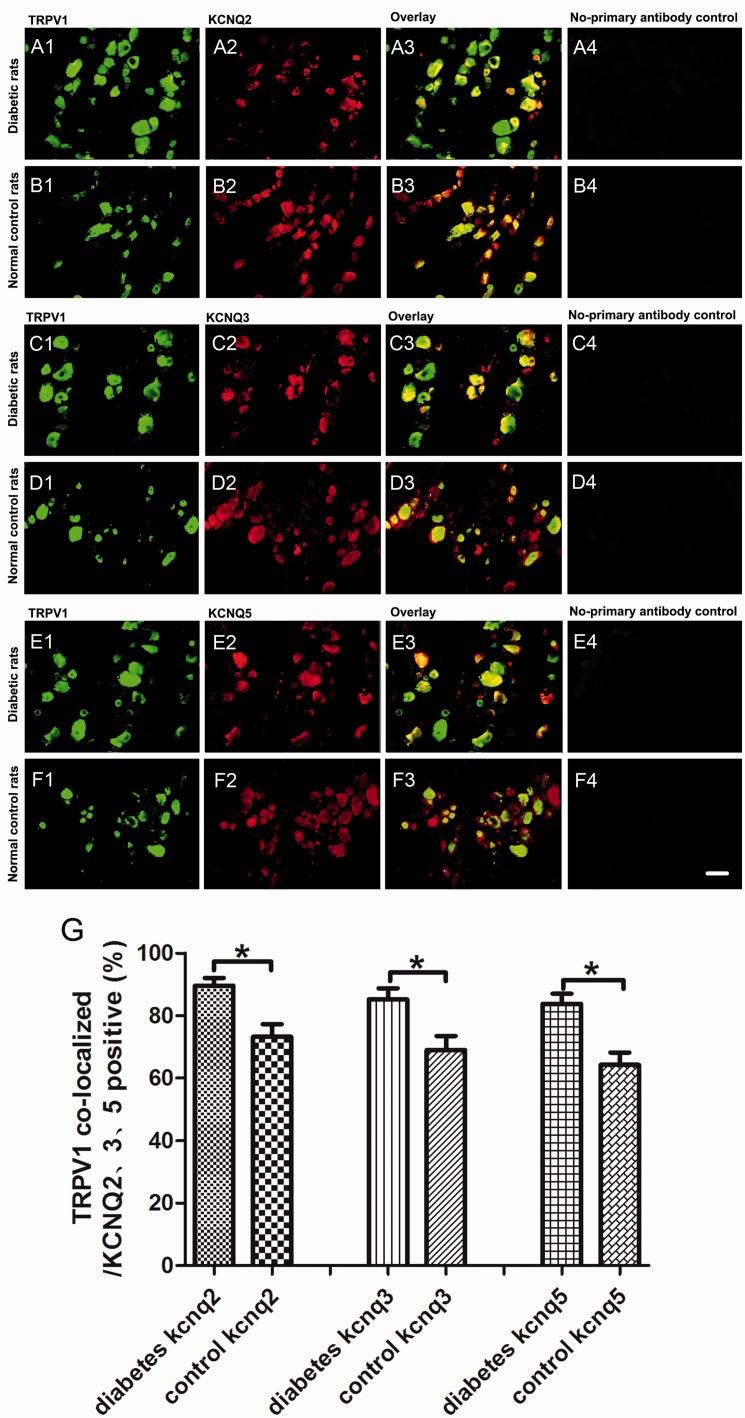 https://cdn.ncbi.nlm.nih.gov/pmc/blobs/fc9e/6088482/13d18f2d54df/10.1177_1744806918793229-fig4.jpg
