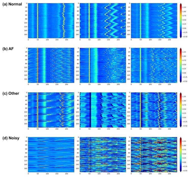 https://cdn.ncbi.nlm.nih.gov/pmc/blobs/ff25/8272104/c3c3412f409f/sensors-21-04331-g003.jpg