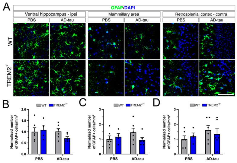 https://cdn.ncbi.nlm.nih.gov/pmc/blobs/ff39/10296847/d780d9deac03/cells-12-01597-g004.jpg