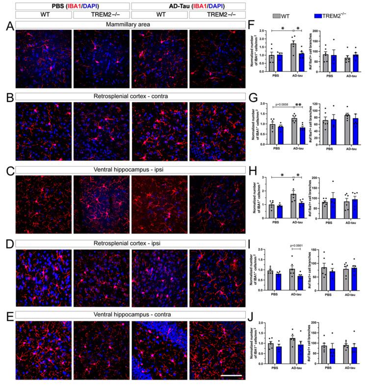 https://cdn.ncbi.nlm.nih.gov/pmc/blobs/ff39/10296847/f652fb8839c9/cells-12-01597-g003.jpg
